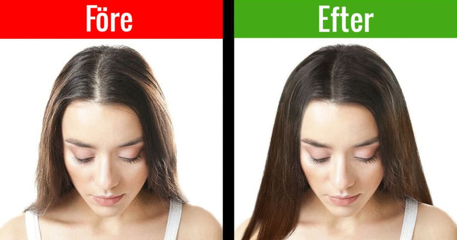 Det finns faktiskt tillfällig hjälp mot tillfälligt håravfall