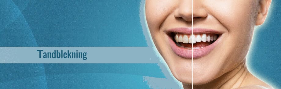 Produkter för vita tänder – vad är hållbart?